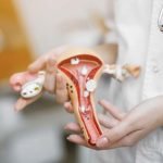Gynecology - About Menorrhagia (Heavy Menstrual Bleeding)