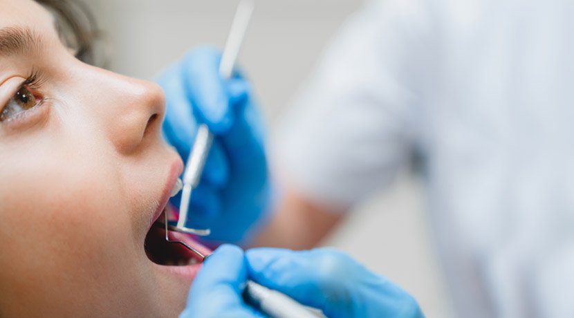 Understanding Tooth Decay - 5 Facts about Cavities